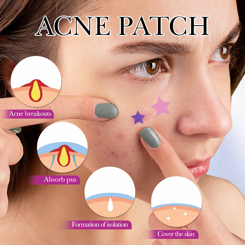 7/10/14Pcs Bunte Sterne Akne P – Skincare Qv Bewertung und Preis