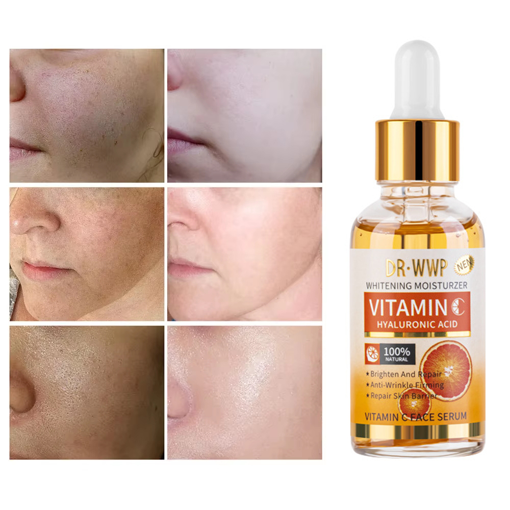 Disaar Vitamin C 30ml Gesichts – Skincare Garnier Bewertung und Preis