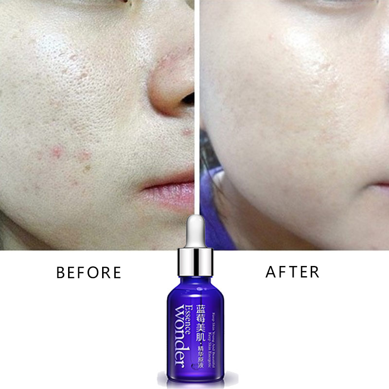 BIOAQUA Heidelbeere Gesicht Li – Skincare Garnier Bewertung und Preis