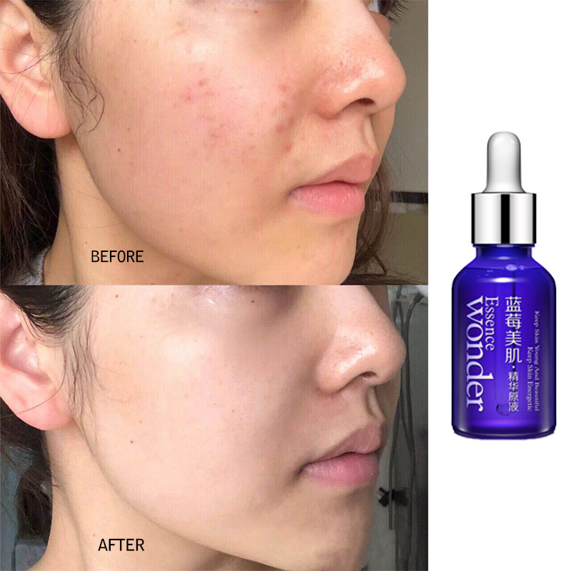 BIOAQUA Heidelbeere Gesicht Li – Skincare Garnier Bewertung und Preis