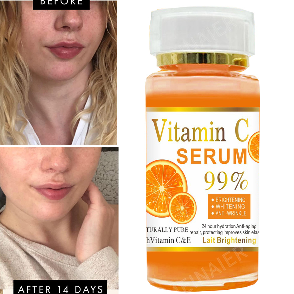 120 ml 99 % Vitamin C Serum Öl – Skincare Garnier Bewertung und Preis