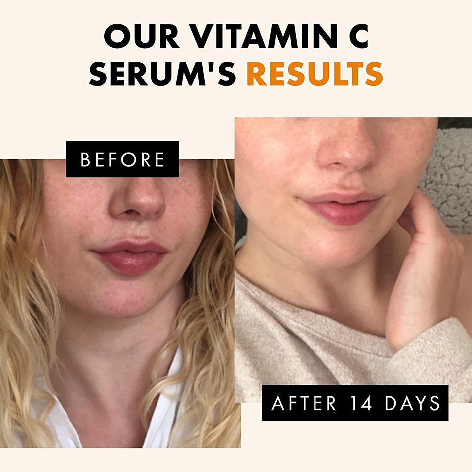 120 ml 99 % Vitamin C Serum Öl – Skincare Garnier Bewertung und Preis