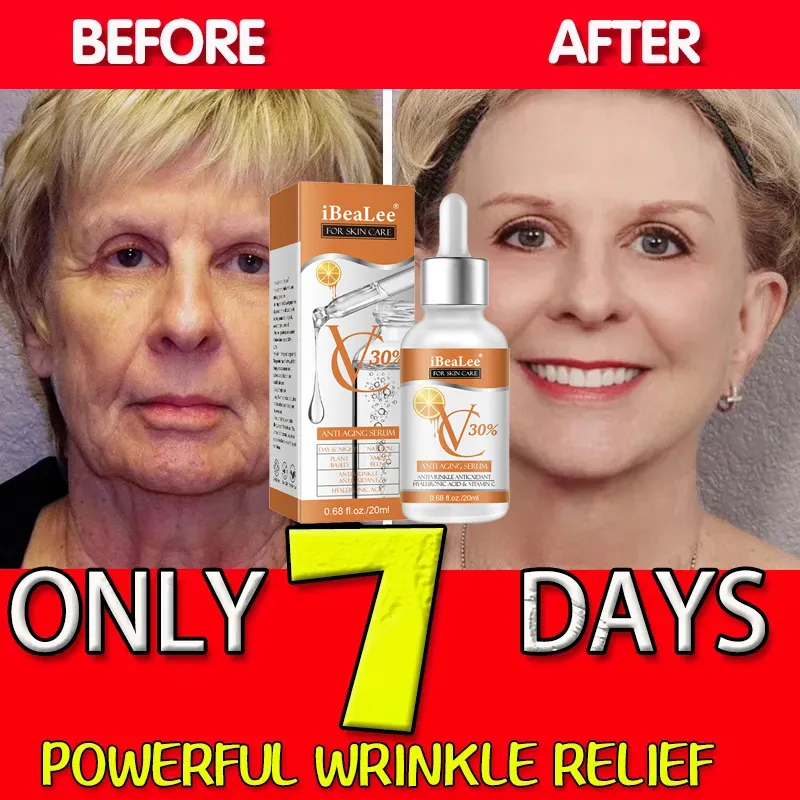 Premium 30% Vitamin C Serum fü – Skincare Garnier Bewertung und Preis