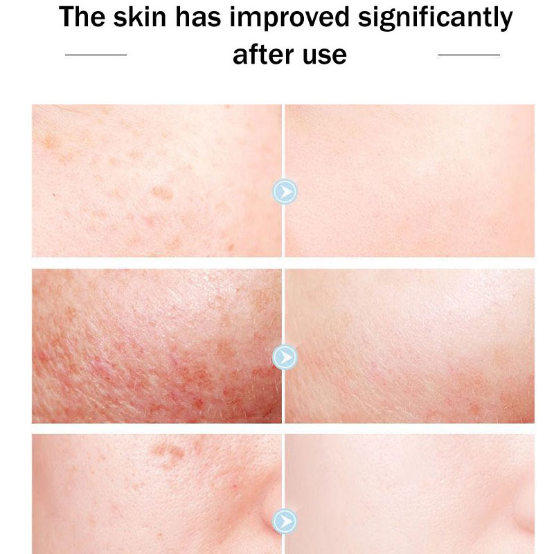 Original Königin Marke Gesicht – Skincare Queen Bewertung und Preis